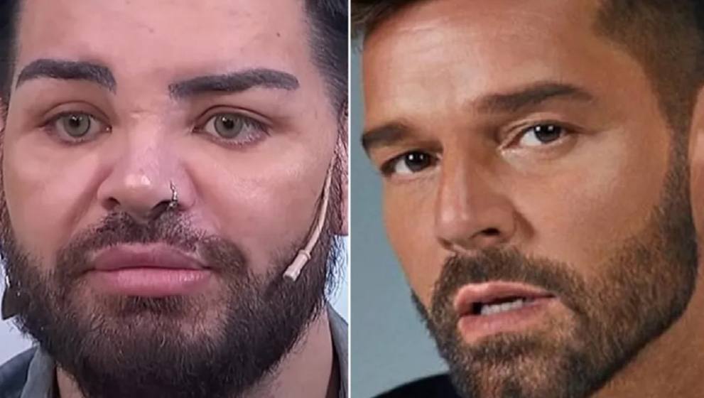 Ator Faz Cirurgias Pl Sticas Para Se Parecer Ricky Martin