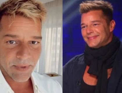 Imagem do post: Ricky Martin se pronuncia após críticas a suposta harmonização facial: “reação alérgica”