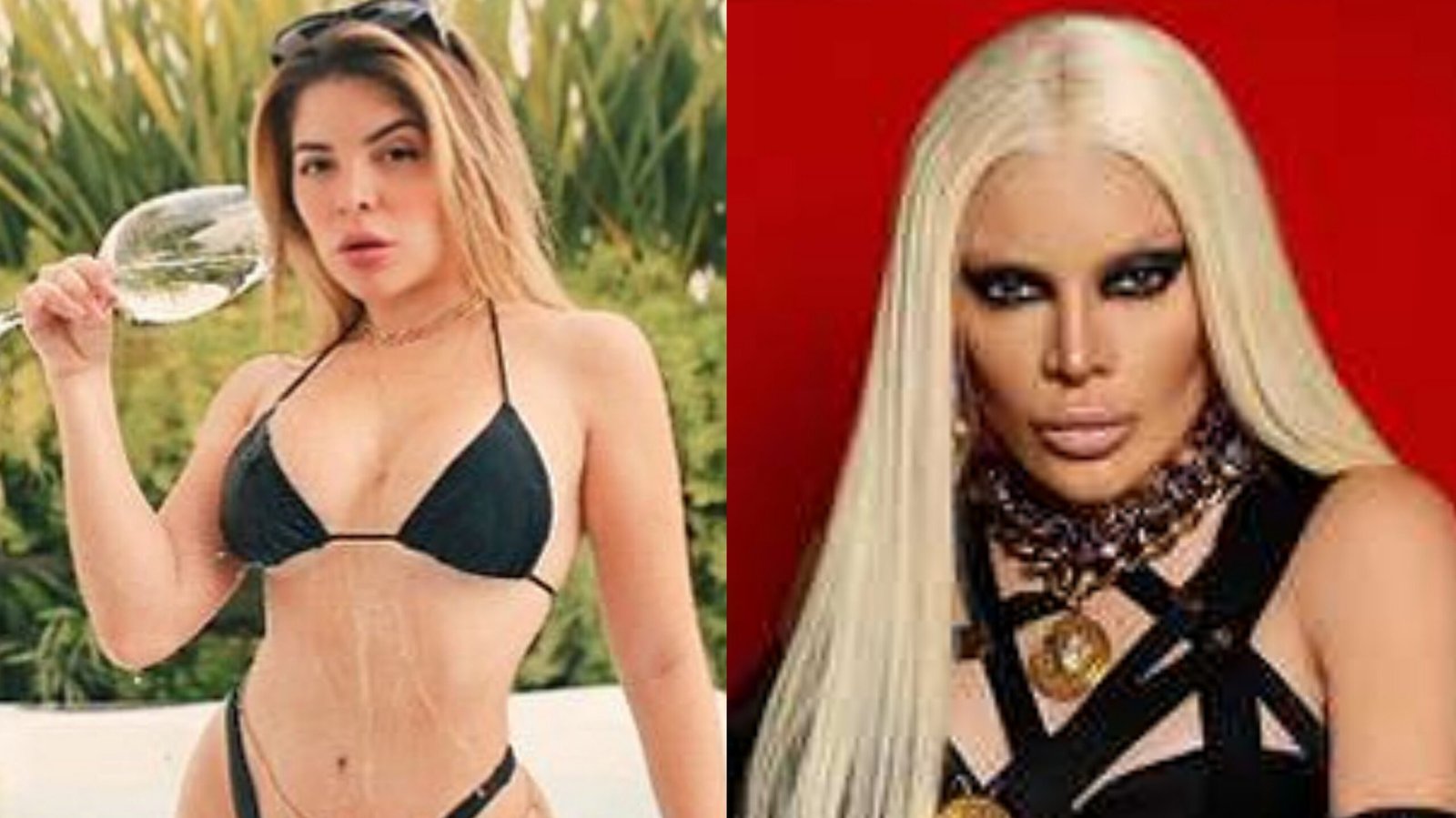 Gkay se enfurece com críticas as suas plásticas: "Deixa eu ser feia em paz"