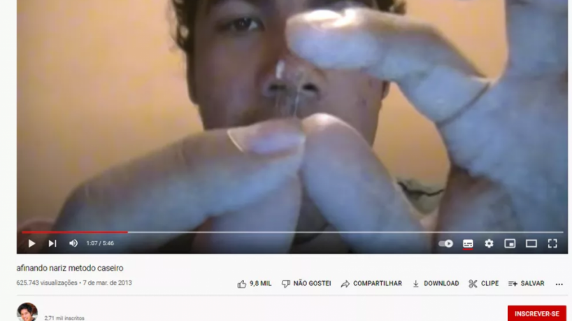 Homem rinoplastia caseira nariz