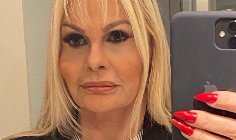 Monique Evans exibe resultado de minilifting facial: "Estou chocada"; veja 49 Monique Evans