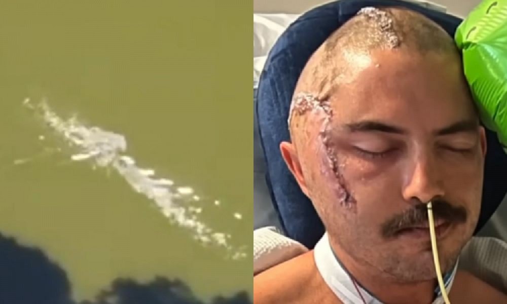 Homem tem cabeça abocanhada por jacaré