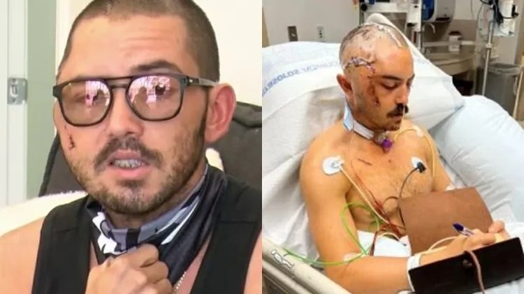 homem atacado jacaré