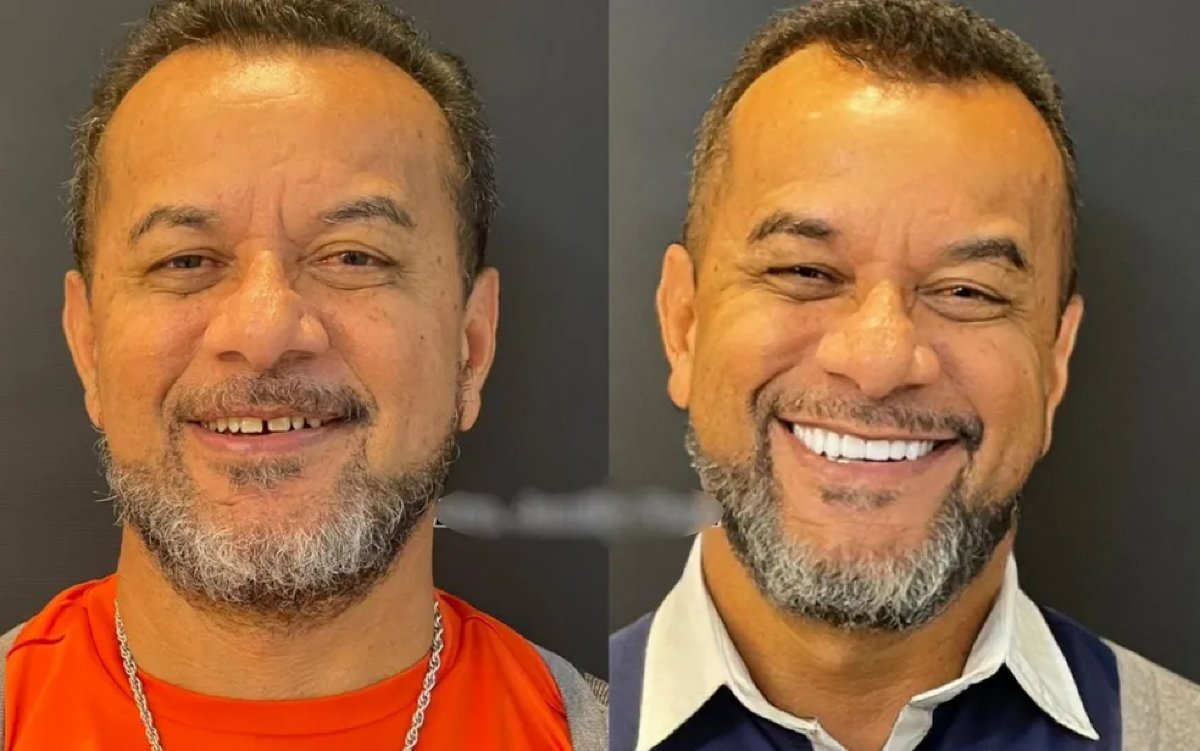 Homem morre prótese dentaria