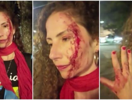 Imagem do post: VÍDEO: Jornalista da CNN Brasil com adesivo de candidato é agredida em Curitiba; imagens chocam