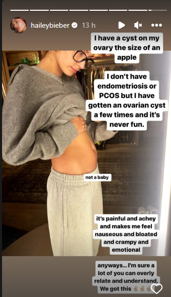 Hailey Bieber desabafa sobre cisto no ovário: “Não é um bebê”