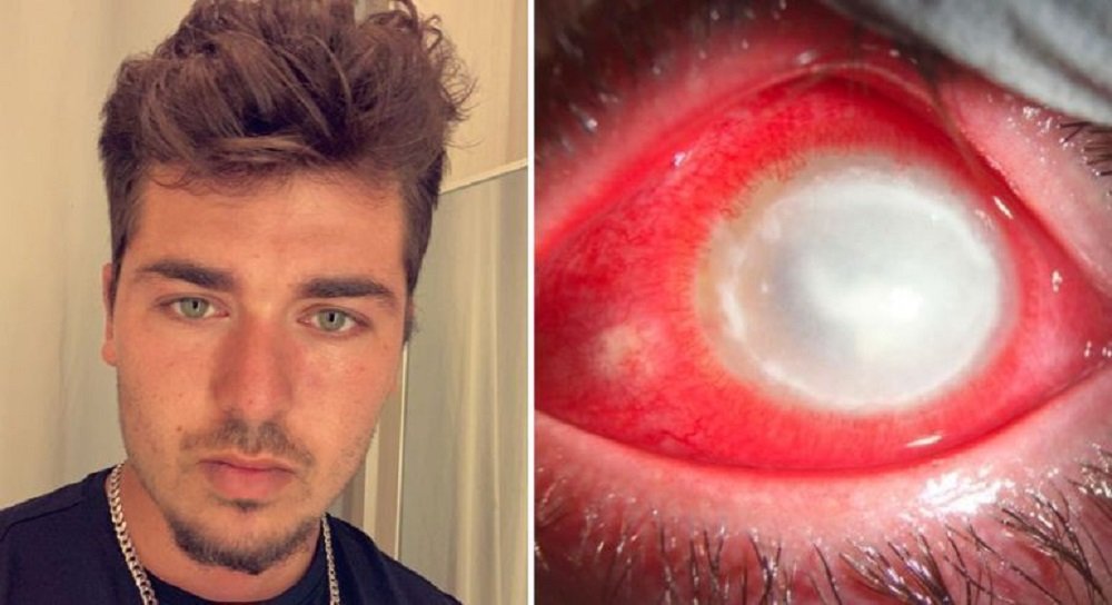 parasita carnívoro devora olho