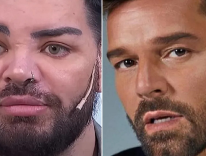 Imagem do post: Ator faz 30 cirurgias plásticas para se parecer com Ricky Martin