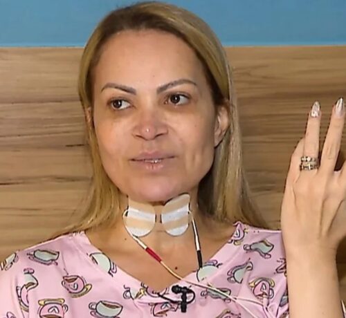 Imagem do post: Solange Almeida revela que está com lesão nas cordas vocais e no pulmão devido o uso de cigarro eletrônico