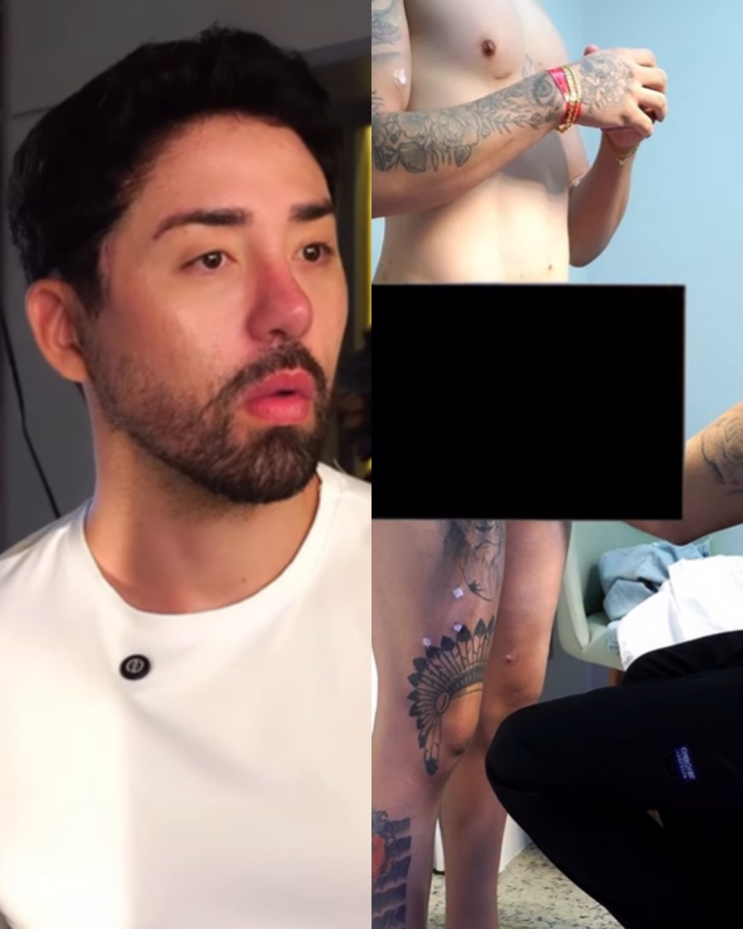 Rico Melquiades faz harmonização peniana