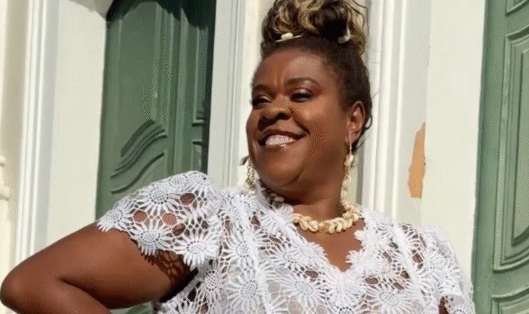 Cacau Protásio atualiza estado de saúde após perder a visão por uso de pomada 48 Cacau Protásio atualiza estado de saúde após perder a visão por uso de pomada