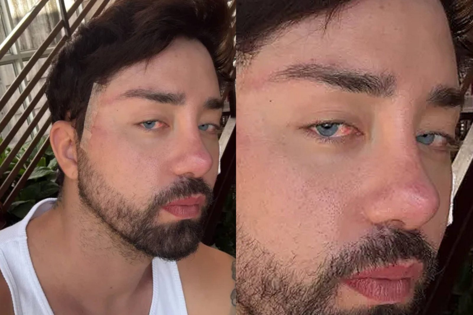 Rico Melquiades surpreende ao surgir com olhos azuis e nova intervenção estética