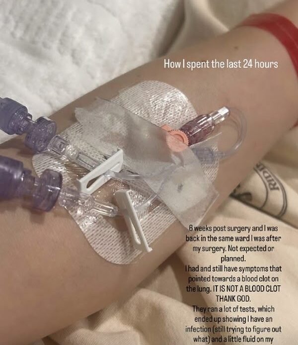 Jessie J é hospitalizada novamente após identificar infecção decorrente de cirurgia para retirada de câncer