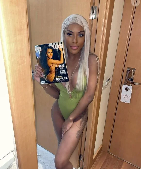 Carol Lekker, a infiltrada de 'A Fazenda 17', gastou R$ 300 mil em procedimentos estéticos antes do reality