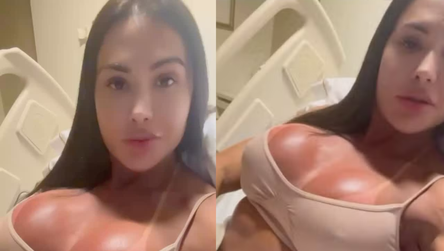 Gracyanne Barbosa revela corpo inchado após lesão em competição de dança: 'Devo estar com 80 kg'