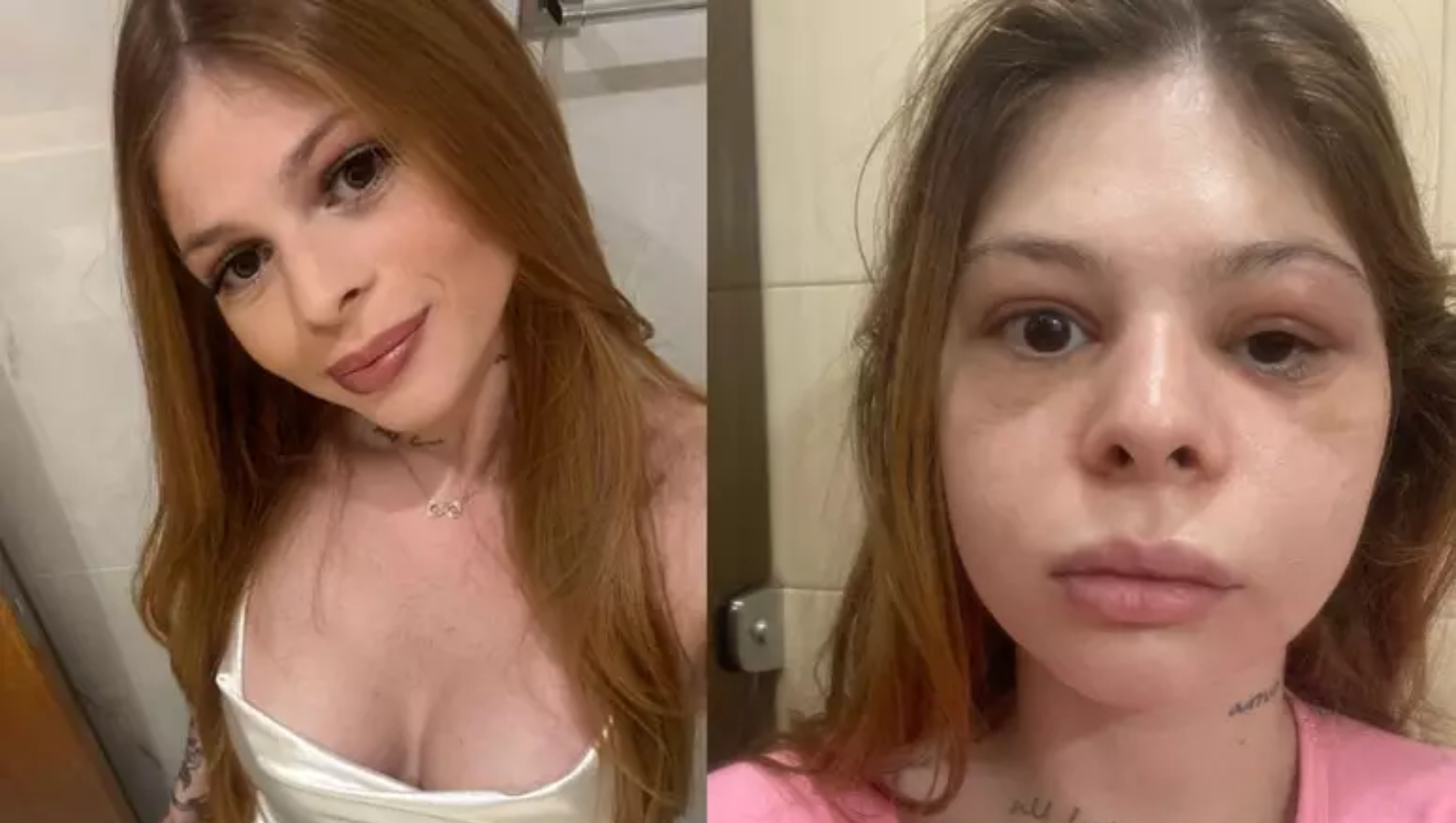 Médica cobre tatuagens feitas por imposição de ex que a espancou: 'Monstro'