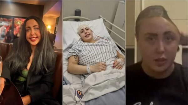 Mulher perde parte do crânio após cair de escada durante noite de bebedeira