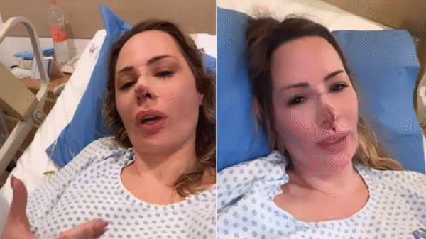 Após quase um ano, influenciadora Ju Isen passará por 3ª cirurgia facial após ataque de cachorro