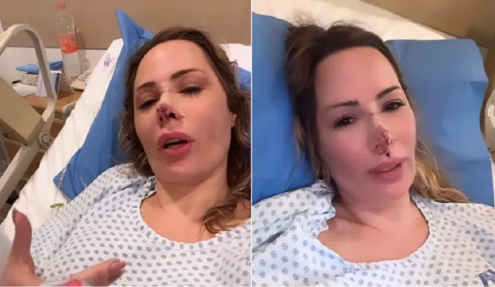 Após quase um ano, influenciadora Ju Isen passará por 3ª cirurgia facial após ataque de cachorro