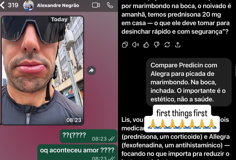Alexandre Negrão é picado por maribondo às vésperas de noivado com Elisa Zarzur; veja foto