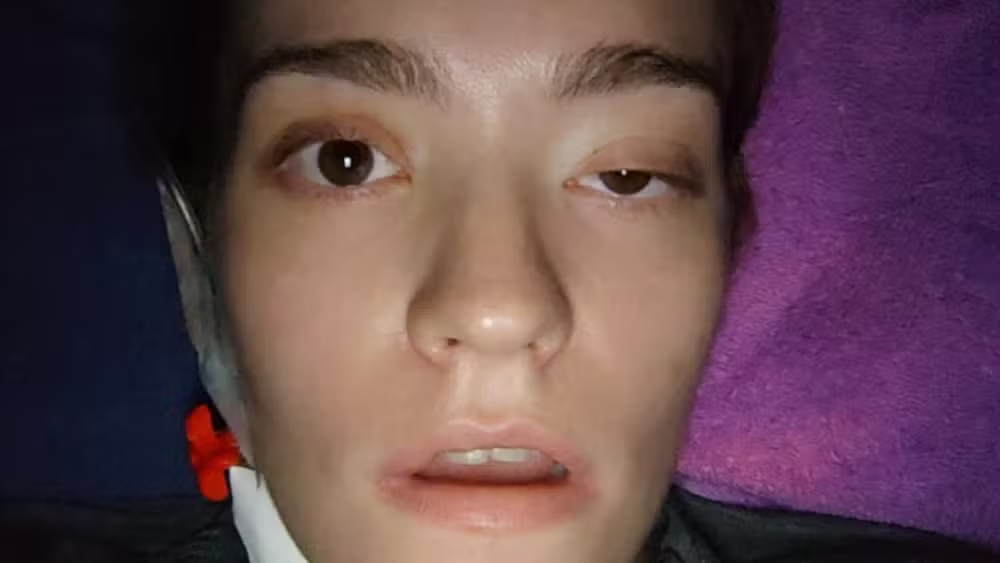Jovem com a “pior dor do mundo” explica verdade sobre aparente melhora 47 Jovem com a “pior dor do mundo” explica verdade sobre aparente melhora