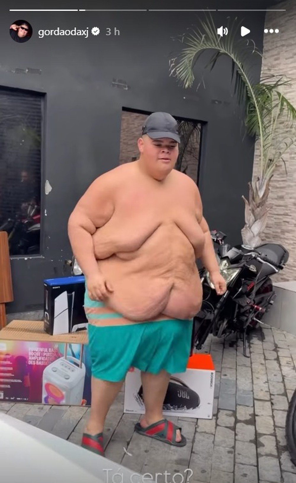 Após perder mais de 115 kg, Gordão da XJ impressiona ao exibir transformação física em vídeo sem camisa 52 Após perder mais de 115 kg, Gordão da XJ impressiona ao exibir transformação física em vídeo sem camisa