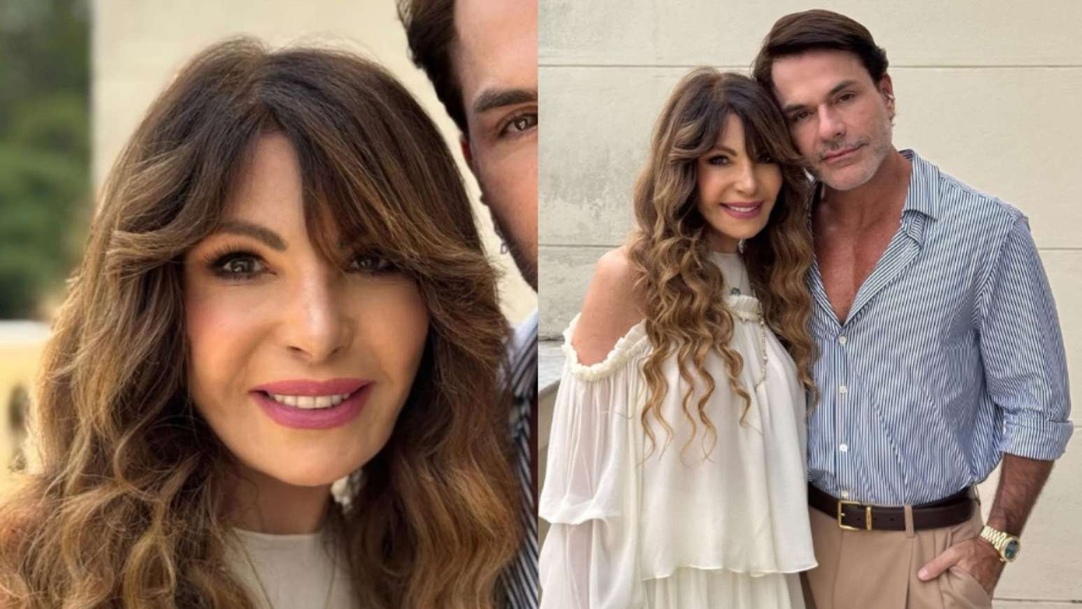 O que Elba Ramalho fez no rosto? Especialista aponta possíveis procedimentos de rejuvenescimento aos 74 anos