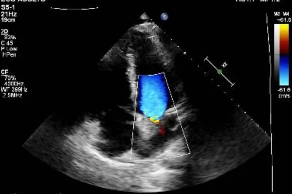 Vittor Fernando mostra bala alojada no coração após sobreviver a tentativa de assalto no Rio 52 Vittor Fernando mostra bala alojada no coração após sobreviver a tentativa de assalto no Rio
