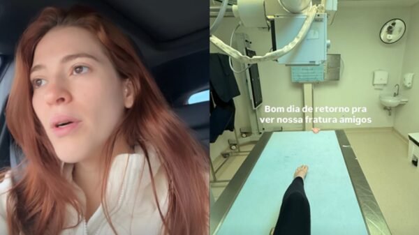 Ana Clara sofre acidente em Nova York e vai parar no hospital: "Fraturado" 5 Ana Clara sofre acidente em Nova York e vai parar no hospital: "Fraturado"