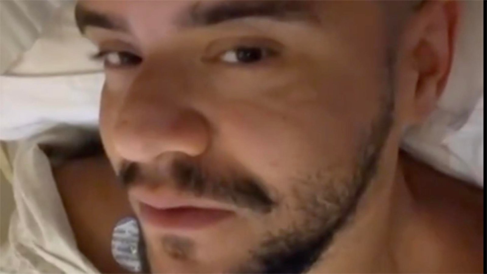 Gominho passa por cirurgia para retirar pedras nos rins e mostra material removido