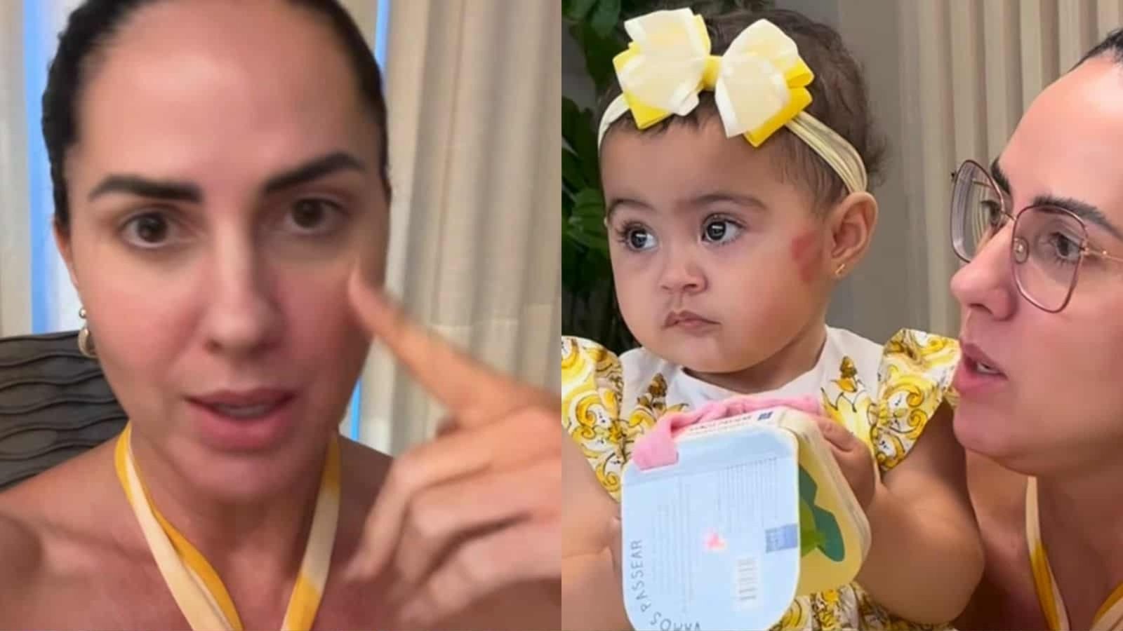 Graciele Lacerda esclarece mancha no rosto da filha; veja