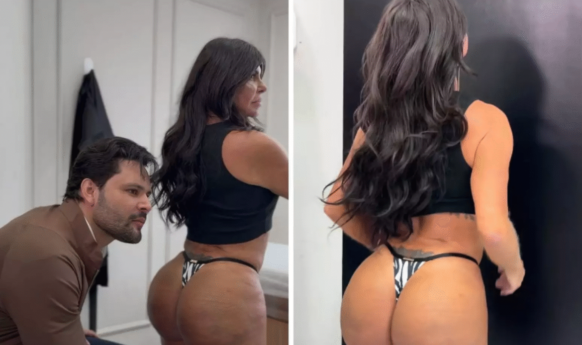Gretchen passa por harmonização no bumbum após quatro meses de tratamento; veja antes e depois 52 Gretchen passa por harmonização no bumbum após quatro meses de tratamento; veja antes e depois