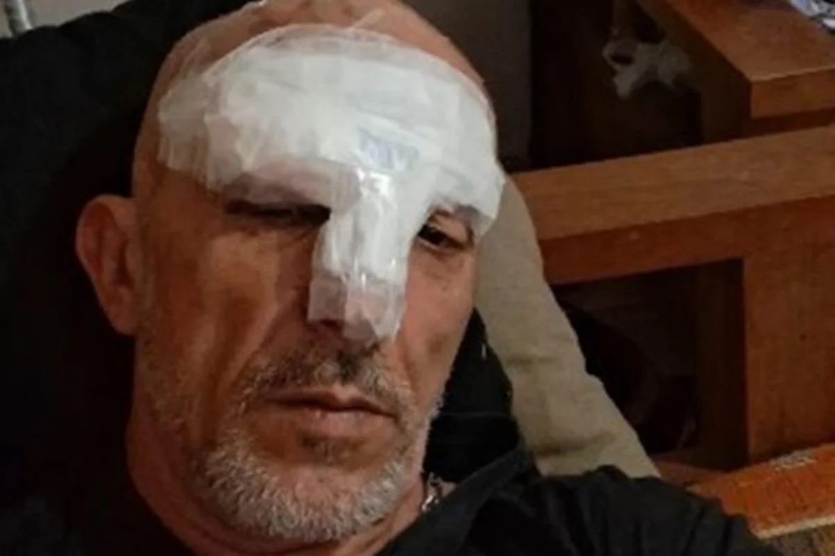 Cristian Cravinhos desabafa após sofrer acidente de moto: “Faz parte” 52 Cristian Cravinhos desabafa após sofrer acidente de moto: “Faz parte”