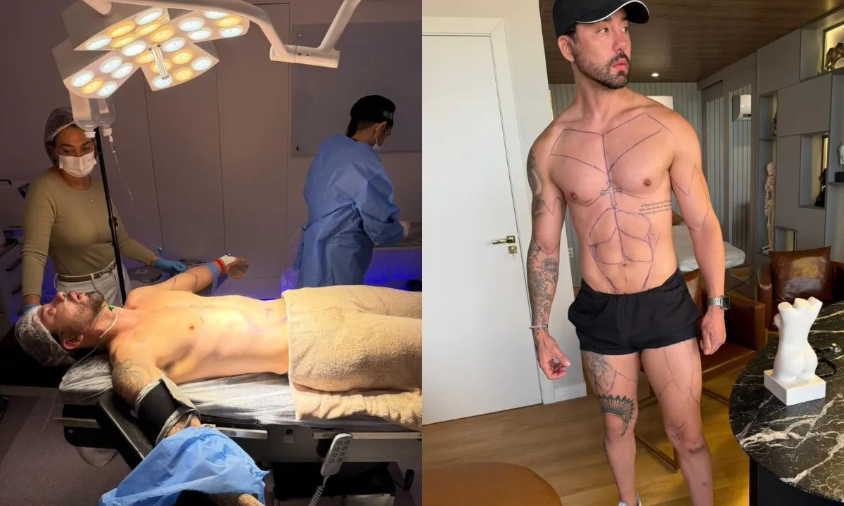 Após aumento peniano, ex-Fazenda Rico Melquíades faz 15ª cirurgia plástica