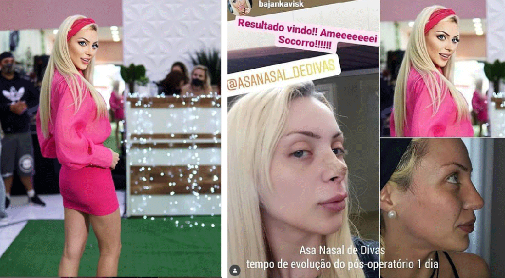 ‘Barbie humana’: o que se sabe sobre a morte da influencer encontrada em casa em SP 53 ‘Barbie humana’: o que se sabe sobre a morte da influencer encontrada em casa em SP