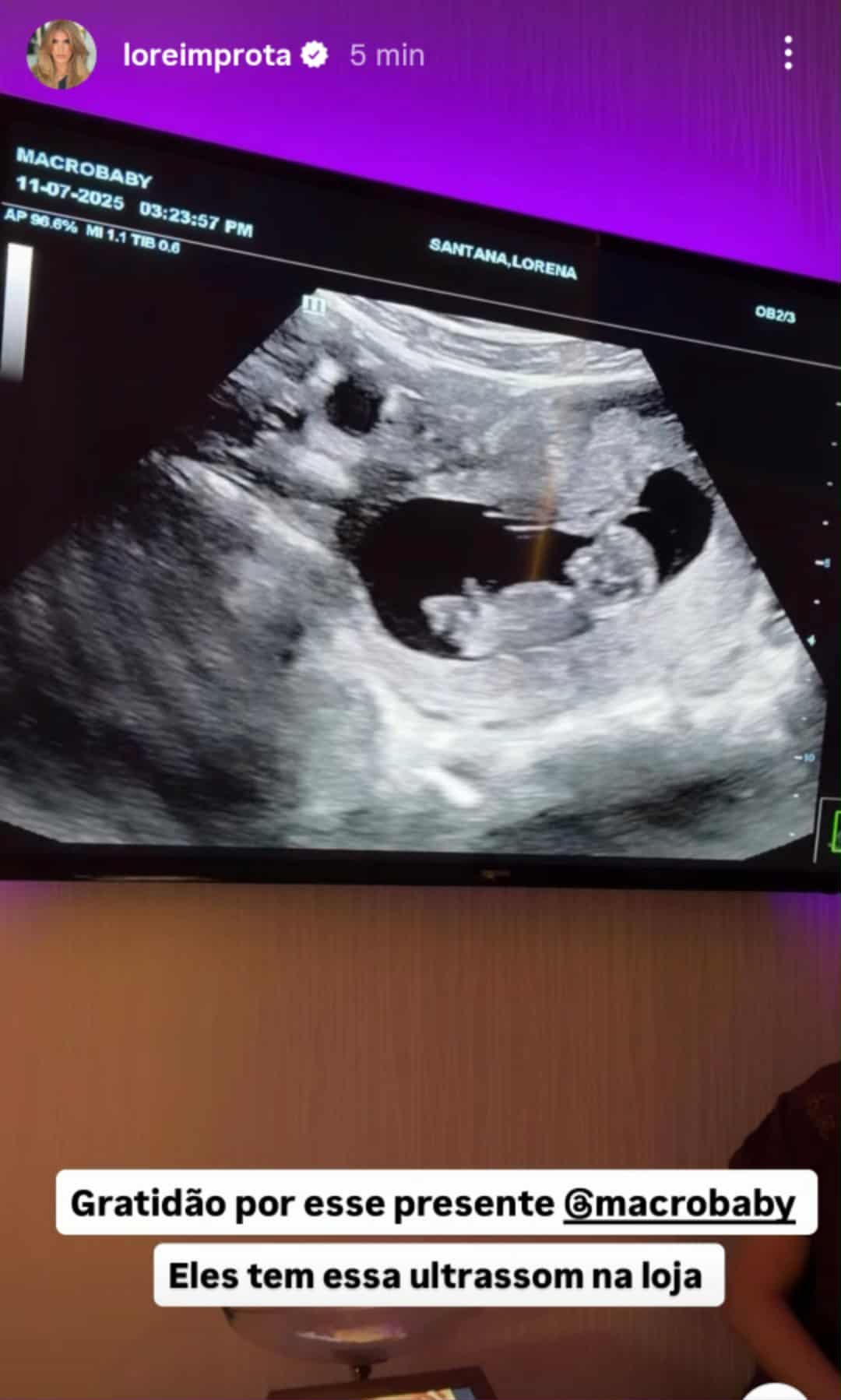 Menina ou menino? Lore Improta mostra ultrassom do bebê com Léo Santana durante viagem aos EUA 52 Menina ou menino? Lore Improta mostra ultrassom do bebê com Léo Santana durante viagem aos EUA