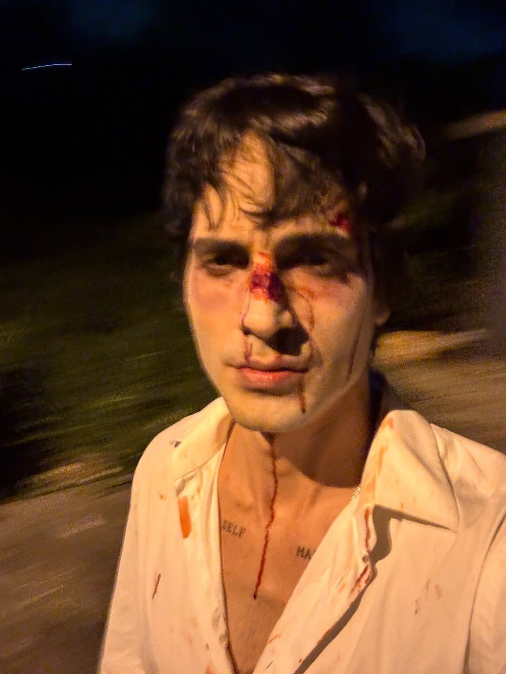 Fiuk surge com rosto machucado nas redes sociais e preocupa fãs em meio a polêmicas