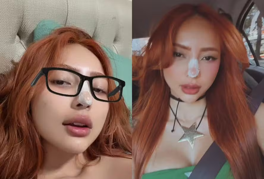 Ruivinha de Marte realiza novos procedimentos estéticos no rosto e exibe resultados nas redes