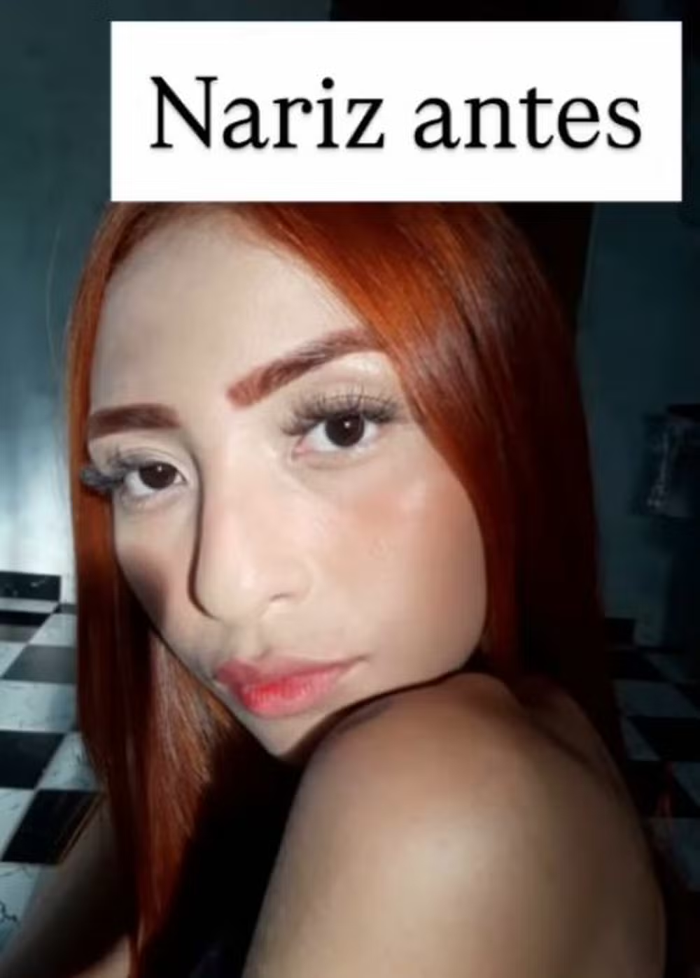 Ruivinha de Marte realiza novos procedimentos estéticos no rosto e exibe resultados nas redes