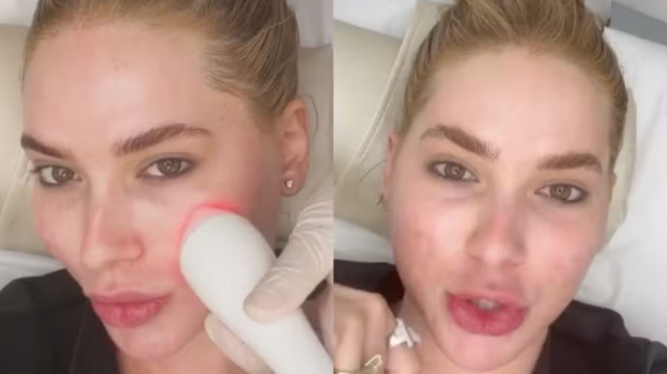 Virginia Fonseca mostra resultado — Foto: Reprodução/Instagram