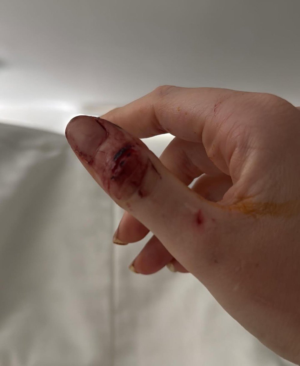 Ex de Dado Dolabella, Marcela Tomaszewski divulga prints e relata agressões físicas, emocionais e psicológicas