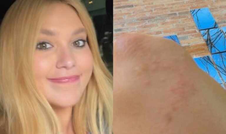 Virginia Fonseca revela crise de pele causada por estresse e ansiedade 53 Virginia Fonseca revela crise de pele causada por estresse e ansiedade