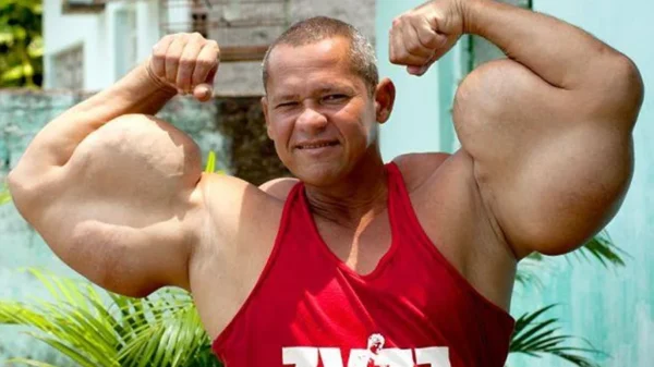 Morre Arlindo de Souza, o “Popeye Brasileiro”, aos 55 anos