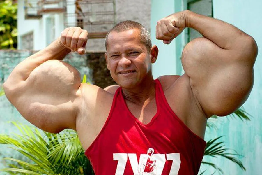 Morre Arlindo de Souza, o “Popeye Brasileiro”, aos 55 anos