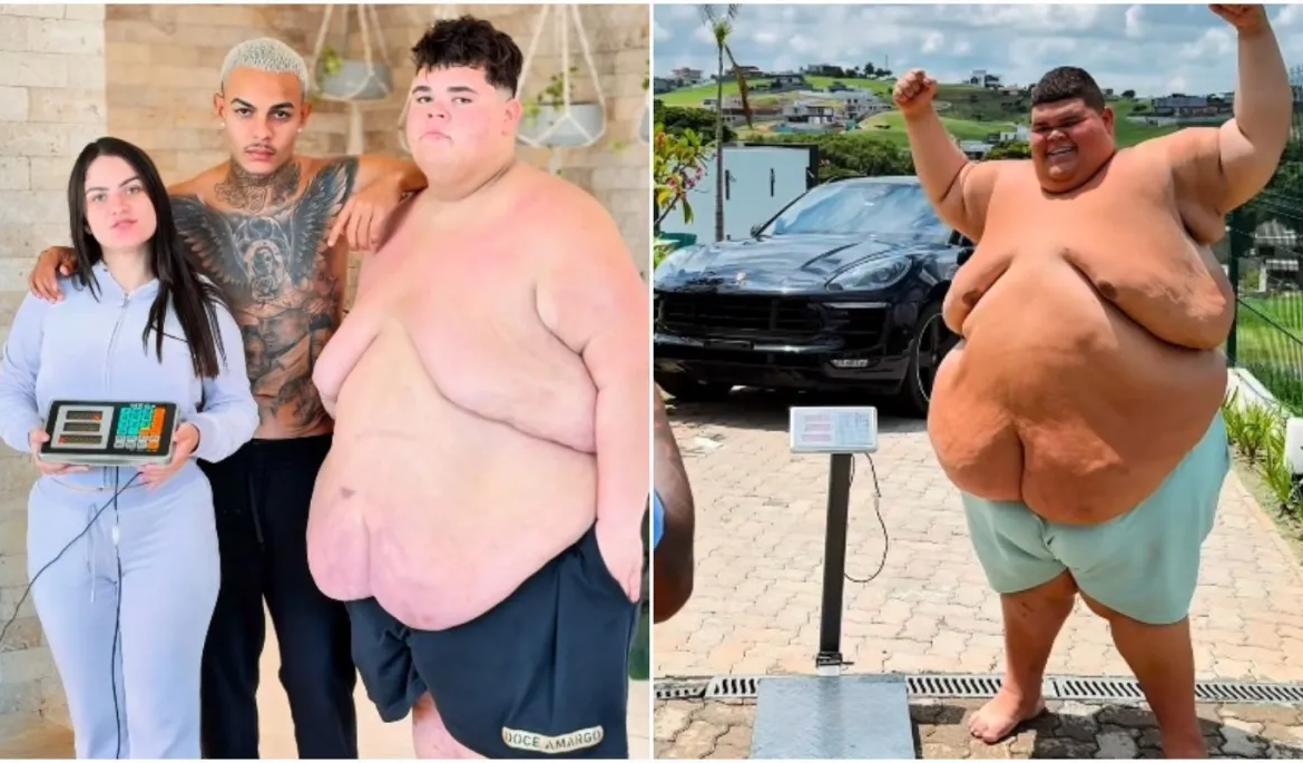 Após emagrecer 130 kg, influenciador Gordão da XJ enfrenta cirurgia considerada de risco 52 Após emagrecer 130 kg, influenciador Gordão da XJ enfrenta cirurgia considerada de risco
