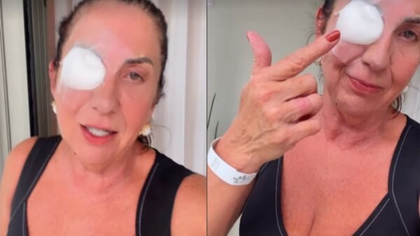 Margareth Serrão passa por cirurgia no olho esquerdo e tranquiliza fãs