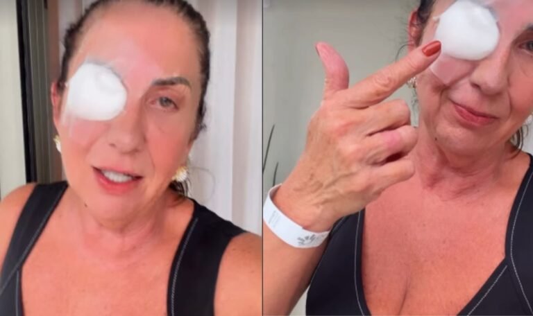 Margareth Serrão passa por cirurgia no olho esquerdo e tranquiliza fãs