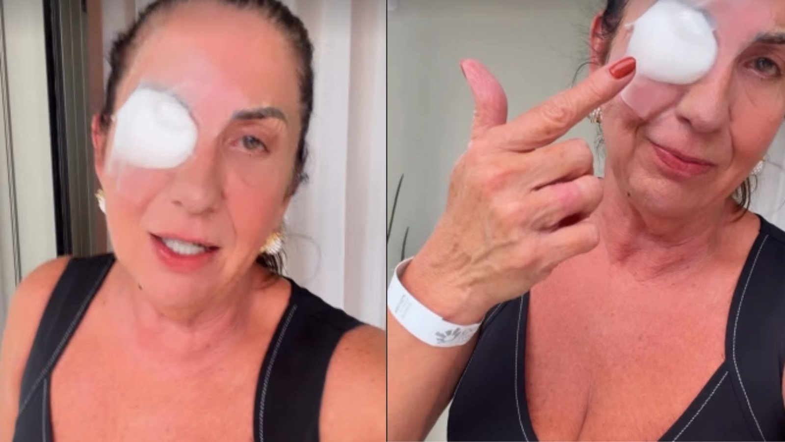 Margareth Serrão passa por cirurgia no olho esquerdo e tranquiliza fãs