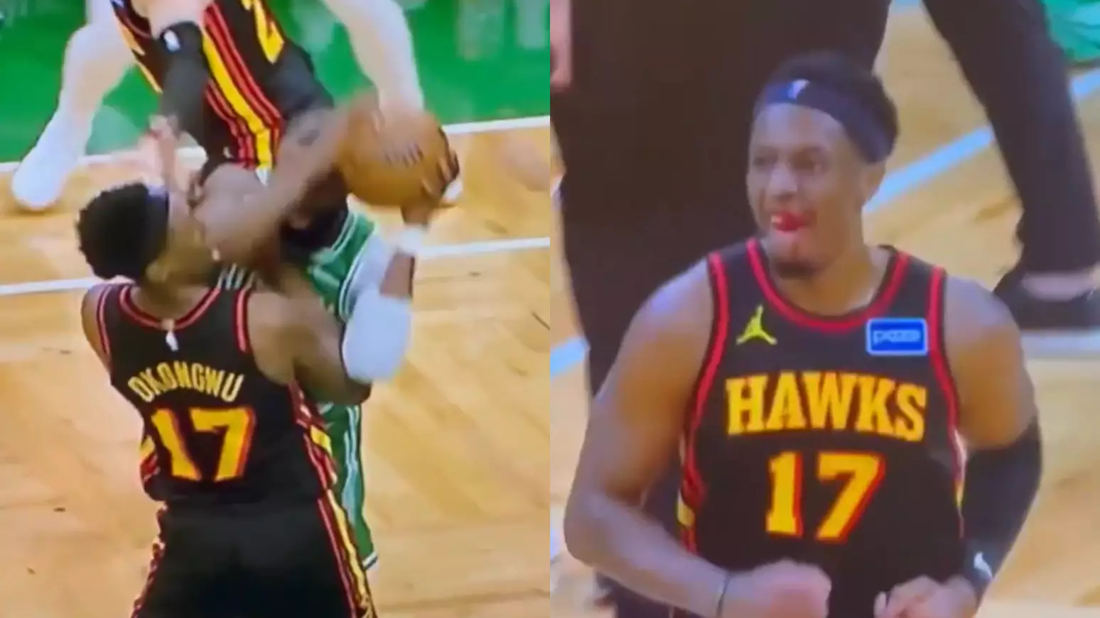 Cotovelada de jogador do Celtics deixa atleta do Hawks sem dentes em partida da NBA; vídeo viralizou