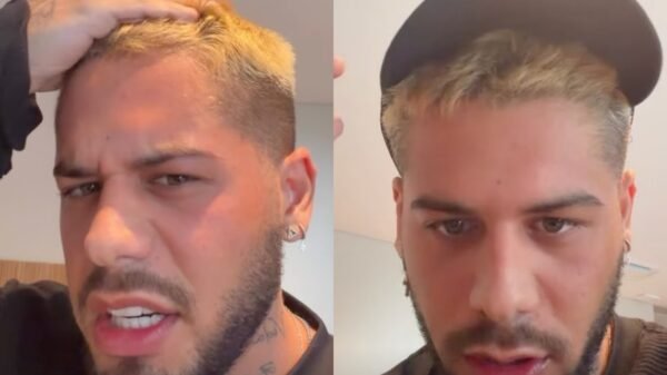 Zé Felipe revela procedimento estético após término de namoro: “Fiz anteontem”